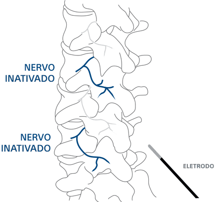 Nervos 3