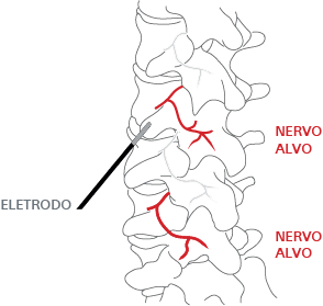 Nervos 1